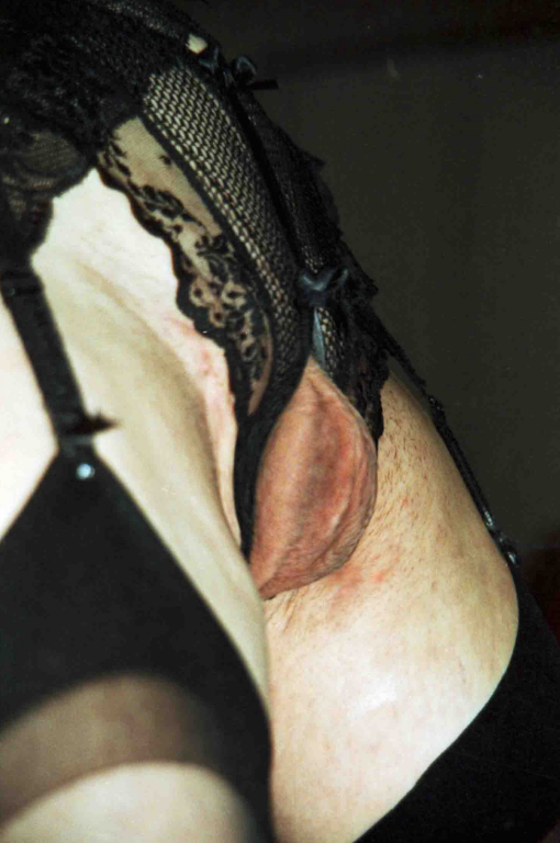 Bild 105409 von carlnapp in Kategorie Exhibitionism