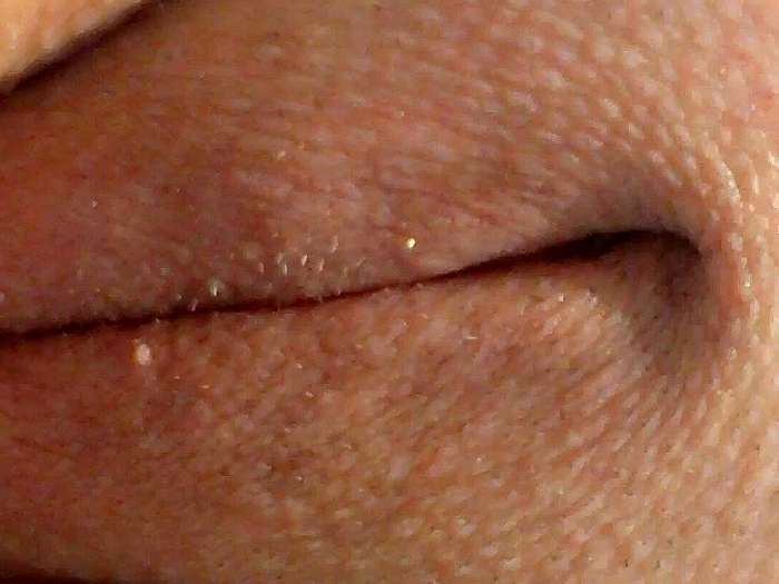 Serie 694087, Bild 2