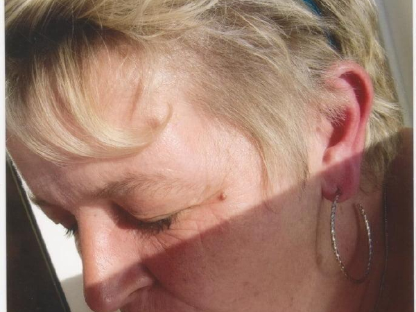 Bild von Schambereich
