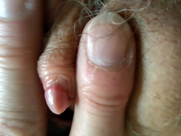 Serie 696848, Bild 2