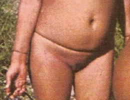 Bild 83772 von Schambereich in Kategorie Public Nude