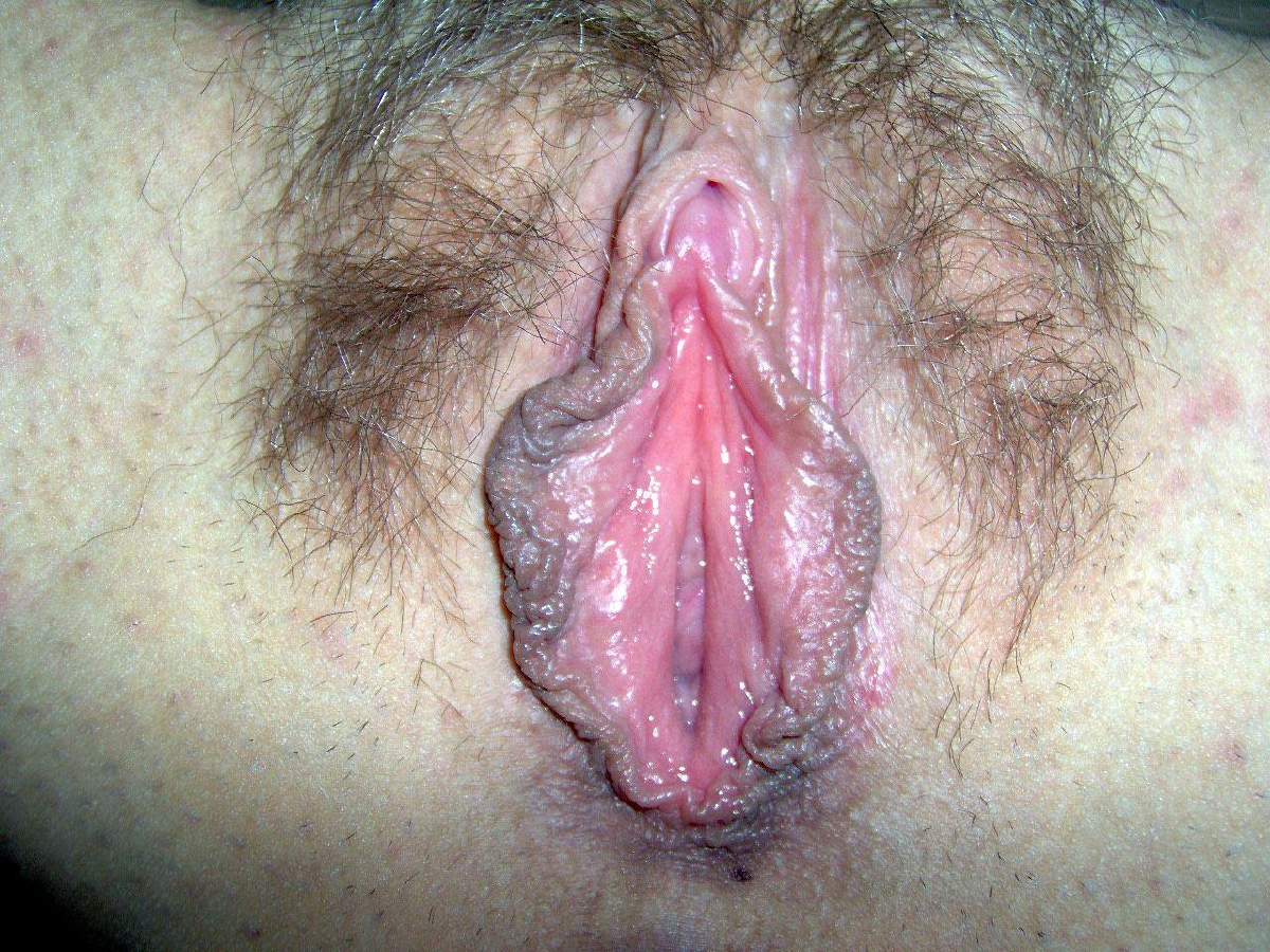 Bild 689650 von Fixfox in Kategorie Schamsituation