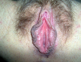 Bild 689650 von Fixfox in Kategorie Schamsituation